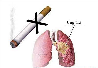 hút thuốc lá ung thư phổi